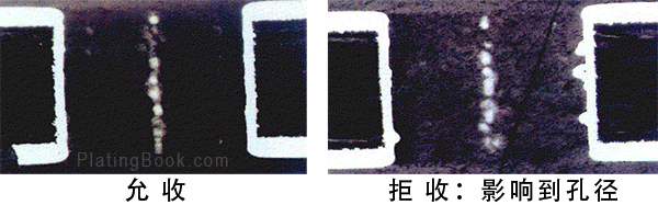 铜瘤的允收标准